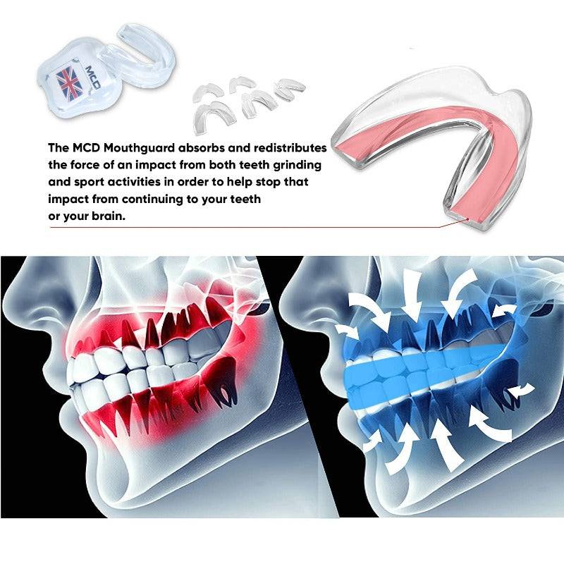 MCD Mouth Guard - Valetica Sports